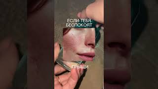 Сыворотка с гиалуроновой кислотой WB арт.: 231074888 OZON арт.: 2017307173