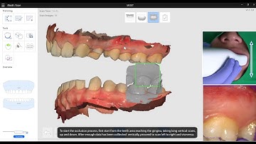 EN How to scan the bite registration
