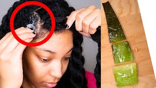 9 FAÇONS D'UTILISER LE GEL D'ALOE VERA POUR LA POUSSE DES CHEVEUX l CHEVEUX PLUS ÉPAIS ET BEAUX