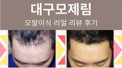 대구모발이식 생착률 높은 모재림 유튜브 신장!