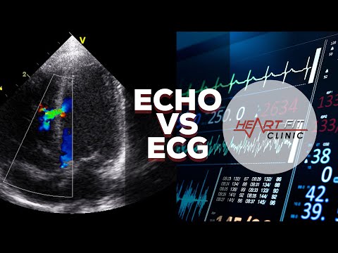 Video: Skillnaden Mellan EKG Och Echocardiogram