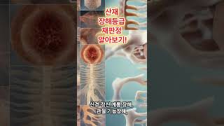 산재 장해등급 재판정 알아보기!