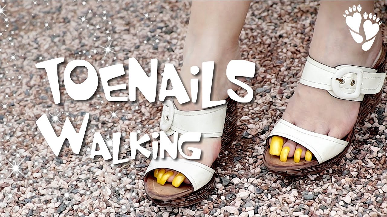 Long Yellow TOENAILS - Walking - YouTube
