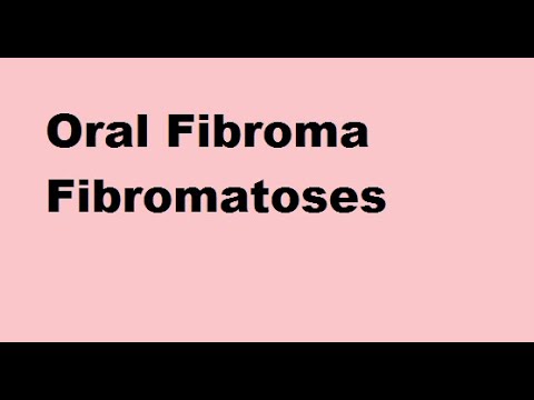 Video: Fibroma - Behandling, Fjernelse, Symptomer