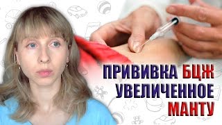 Прививки за и против. Прививка БЦЖ. Положительная реакция манту Прививки за и против. Прививка БЦЖ. Положительная реакция манту