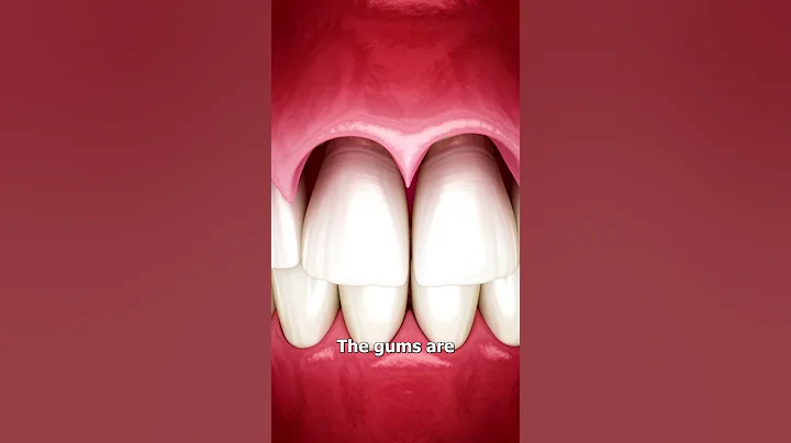 The Surgery To Reveal More Teeth 😨 - DayDayNews