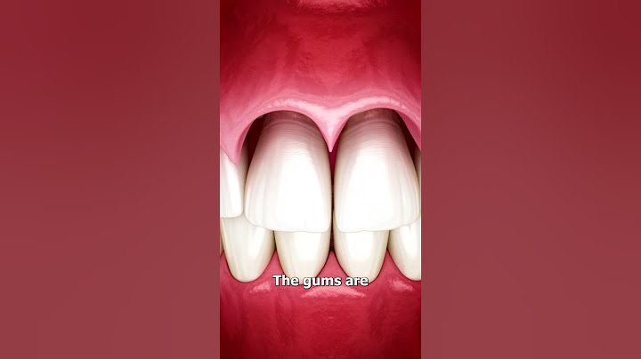 The Surgery To Reveal More Teeth 😨
