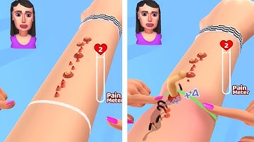 Acne Runner -  All Levels Gameplay Android/iOS