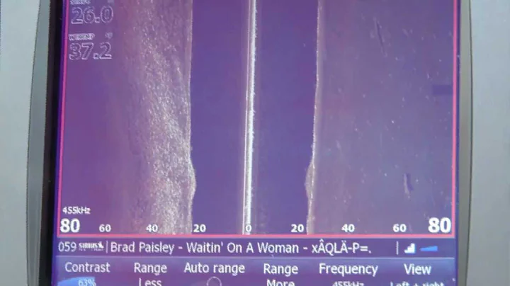Lowrance StructureScan HD