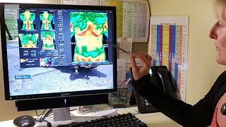 How A Thermography Scan Can Detect A Disease Before It Forms