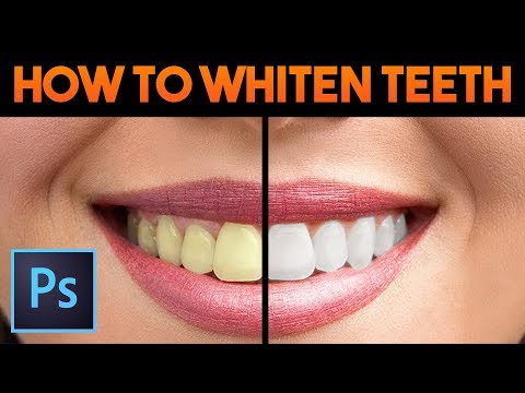 How to Whiten Teeth (Easy & Quick)│Adobe Photoshop Tutorial