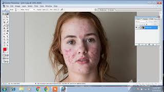 Photoshop me Pimple kaise Remove kiya jata hai? How to Remove Pimples in Photoshop? screenshot 2