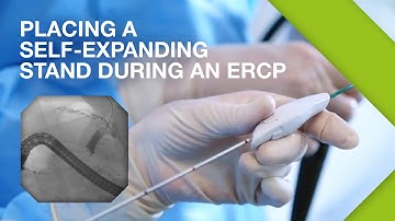 Olympus ERCP | ERCP Practical Guide | Part 3: Placing a Self-expanding Stent | Gastroenterology