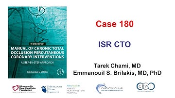 Case 180: Manual of CTO PCI - ISR CTO