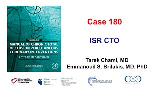 Case 180: Manual of CTO PCI - ISR CTO