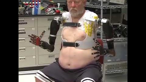 Amputee Makes History with APL’s Modular Prosthetic Limb