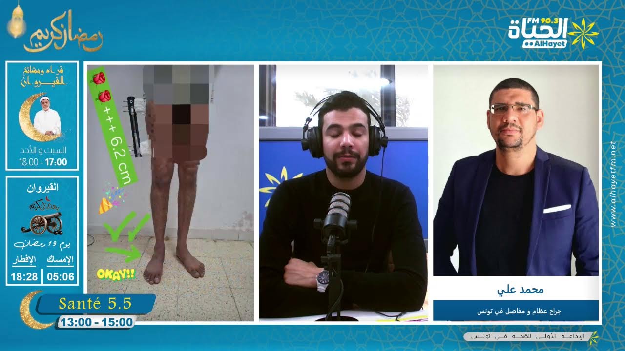 المستشفى الجهوي بتطاوين :إجراء عملية نادرة جداً لتطويل عظم الفخذ لتعويض نقص يبلغ 6.5 سم