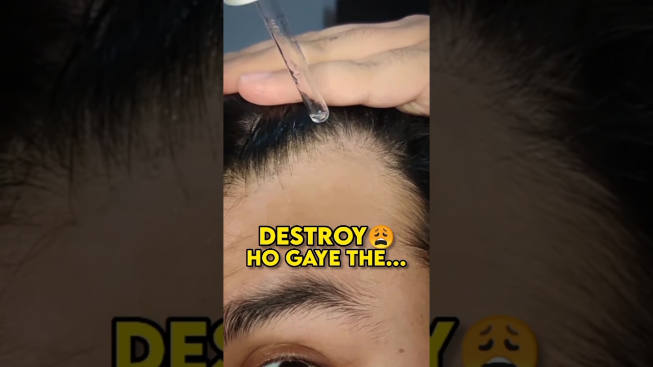 Hair Regrowth Routine ✅ #shorts #hair #hairfall #hairregrowth #hairlinereceding