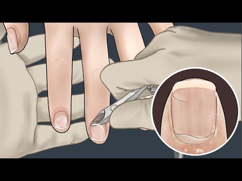 [ASMR] 오감만족! 깨지고 지저분한 손톱 관리 애니메이션💅 / Broken and dirty nail care animation