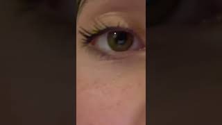 Download Lagu bad features | perfect facial harmony #shorts #face MP3