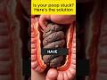 Natural Remedy to Eliminate Stuck Poop!