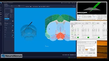 Radiens MPM Integration