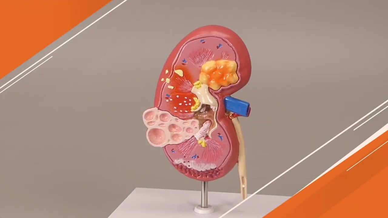Kidney Model Anatomy Normal Human Anatomical Teaching