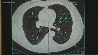 Study shows increase in cancer types affecting women, younger people