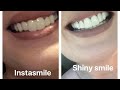 Shiny smile veneers vs instasmile veneers