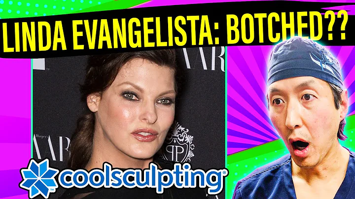How to Avoid Linda Evangelista's CoolSculpting DIS...
