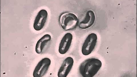 RBC Array manipulated using Elliot Scientific Optical Tweezers