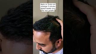 Hair Growth For Man and Woman Hair Oil Making At Home to Stop Hair Fall and Good Hair Growth #hair