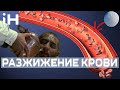 Разжижение крови: профилактика тромбоза и атеросклероза. Советы невролога. #iневролог