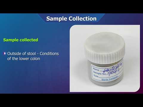 Fecal occult blood test