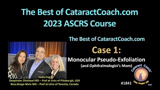 CataractCoach™1841: ASCRS 2023 Course Case 1 monocular pseudo-exfoliation