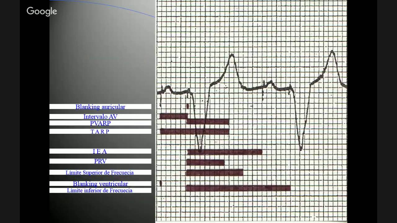MARCAPASOS BICAMERAL camera iphone 8 plus apk