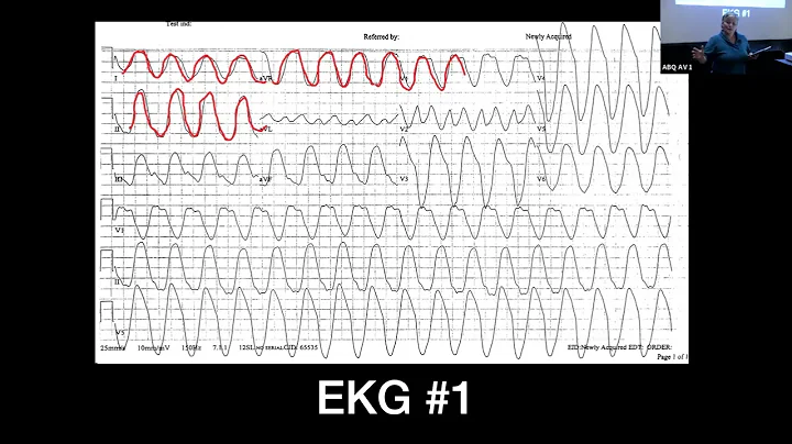 Sharon Schaaf - 12 Lead EKG