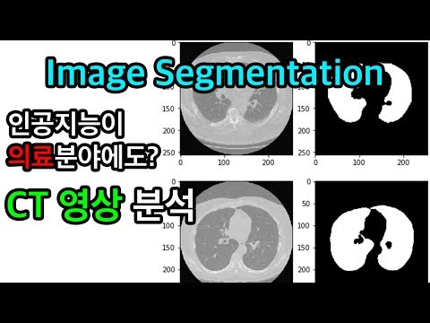 CT Lung Segmentation - Python, Deep Learning