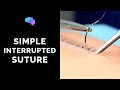 Simple interrupted suture wound suturing  osce guide  ukmla  cpsa