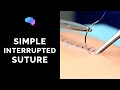 Simple interrupted suture (wound suturing) - OSCE Guide