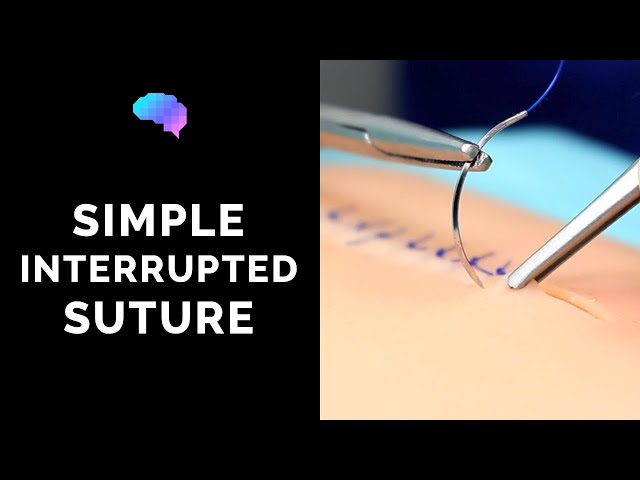 Step-by-Step Guide to Stitches (Placing & Removing Sutures)