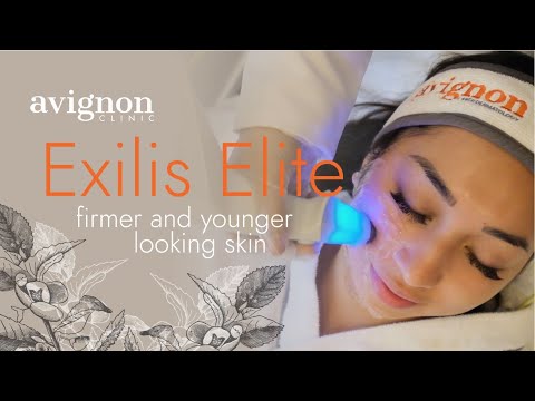 Avignon Exilis Ultra: Melt Fats Away & Reveal a Contoured Face