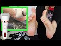 I tried an ELECTRIC FOOT FILE to Remove Hard Skin & Calluses on my Feet.