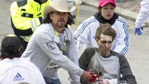 Man loses legs, IDs bombing suspect