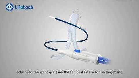 Lifetech Scientific Ankura AAA Demo