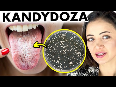 Wideo: Co to jest Candida albicans Dubliniensis?