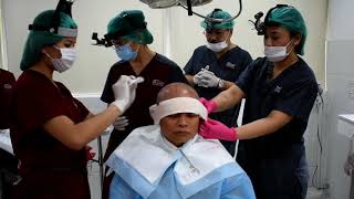 FUE Hair Transplant by Nu/Hart Hair Restoration Philippines