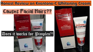 Eventone-C Whitening Cream My Honest Experience//Does it Works??Side Effects//Original??