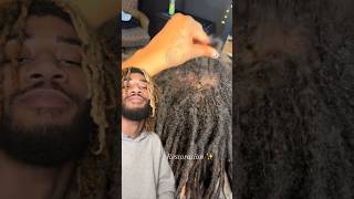 INCREDIBLE Balding Locs Restoration #shorts