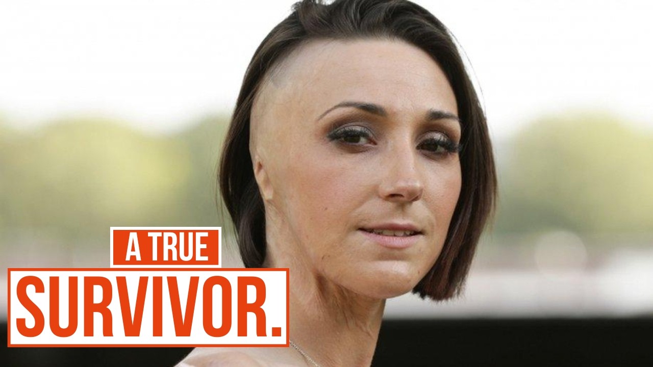 Documentary backdrop image for The Powerful Story of Adele Bellis, Acid Attack Survivor | Survivors (2026)